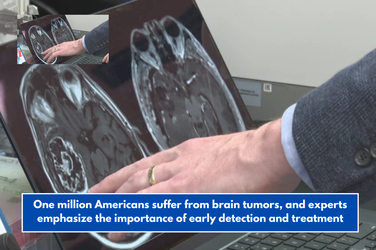 One million Americans suffer from brain tumors, and experts emphasize the importance of early detection and treatment