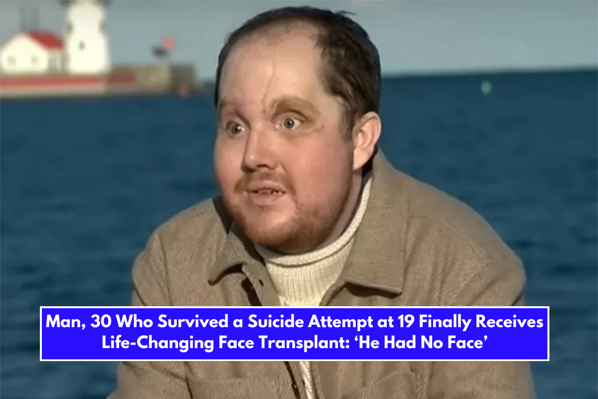Man, 30 Who Survived a Suicide Attempt at 19 Finally Receives Life-Changing Face Transplant ‘He Had No Face’