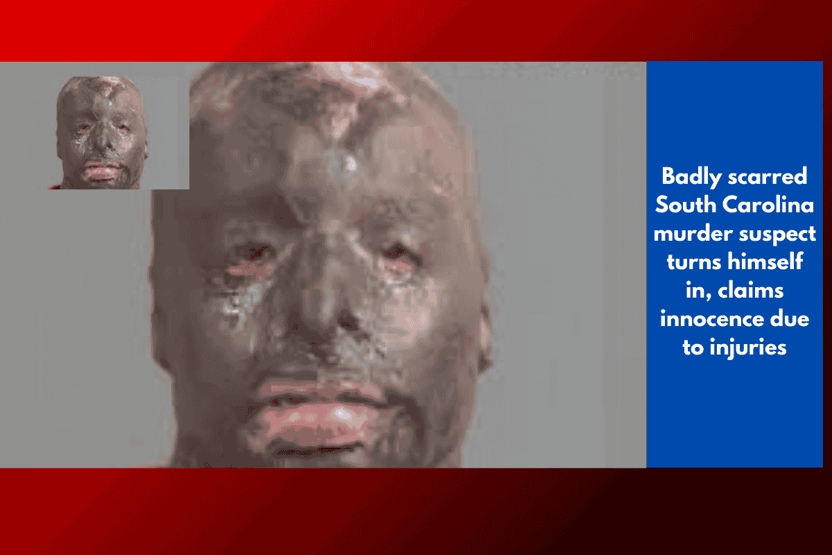 Badly scarred South Carolina murder suspect turns himself in, claims innocence due to injuries