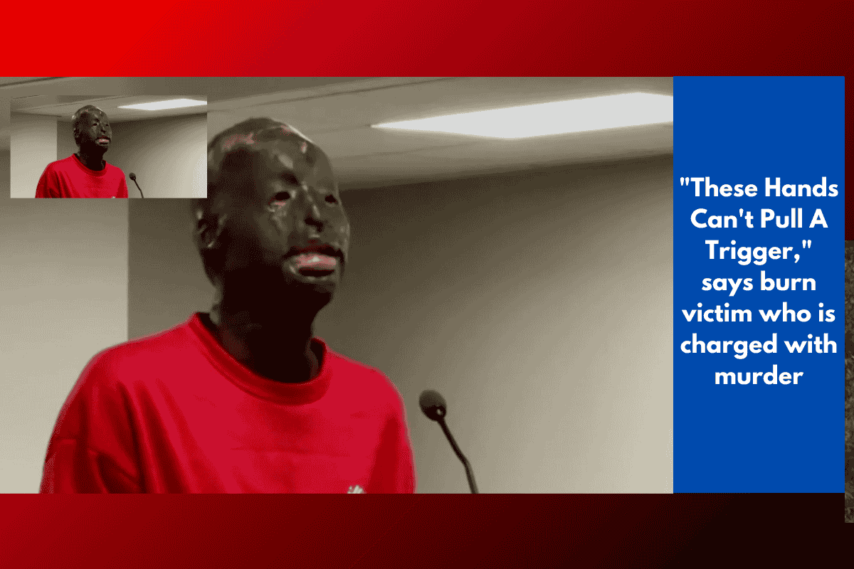 "These Hands Can't Pull A Trigger," says burn victim who is charged with murder