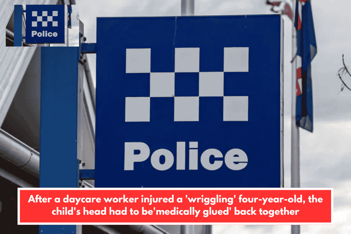 After a daycare worker injured a 'wriggling' four-year-old, the child's head had to be'medically glued' back together