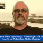 Shark Attack Victim Shares Images of Shocking 10-Inch Thigh Scar From Great White Attack: 'No Hard Feelings'