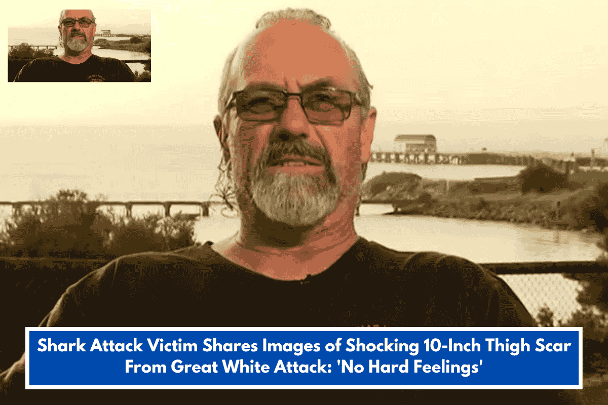 Shark Attack Victim Shares Images of Shocking 10-Inch Thigh Scar From Great White Attack: 'No Hard Feelings'