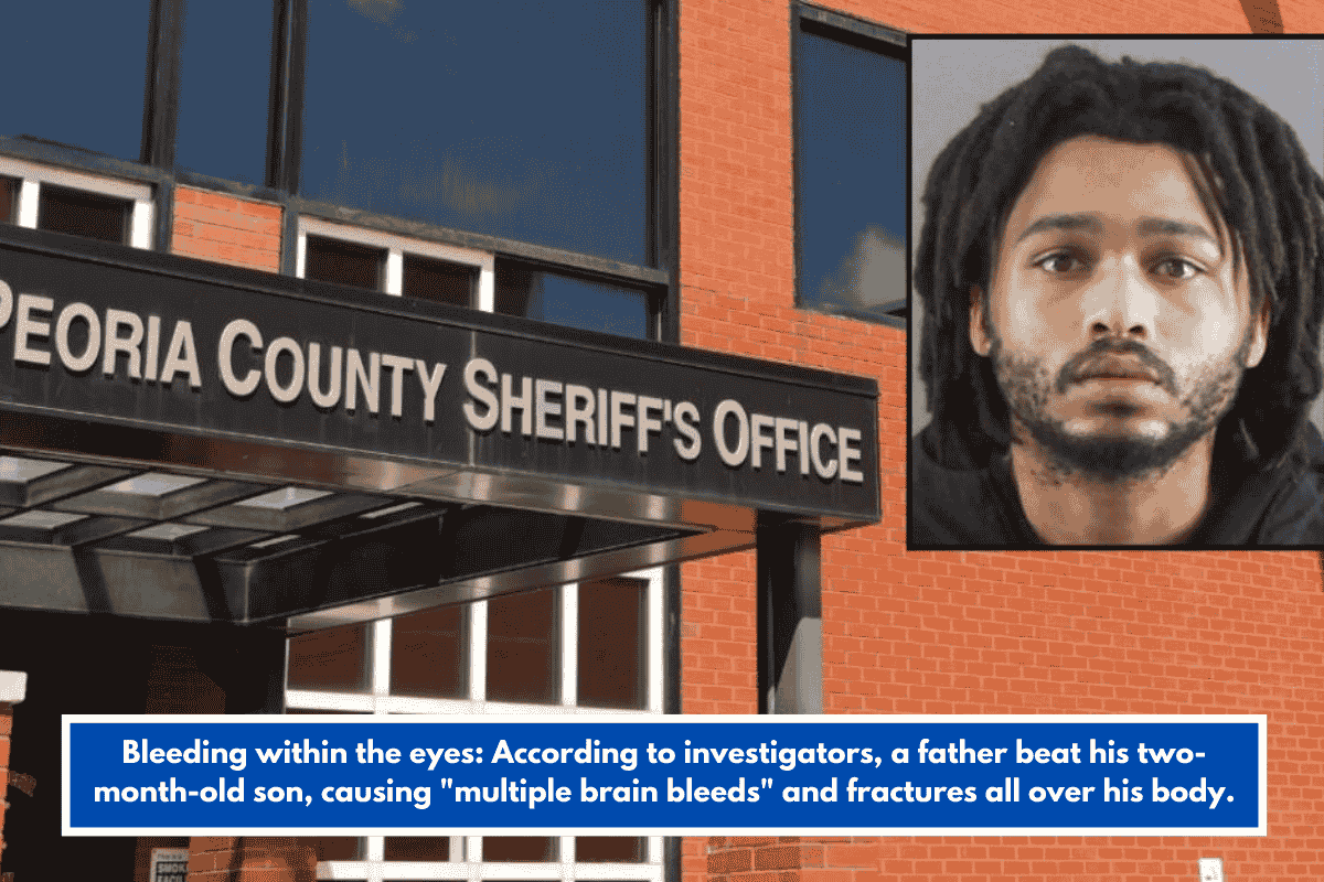 Bleeding within the eyes: According to investigators, a father beat his two-month-old son, causing "multiple brain bleeds" and fractures all over his body.