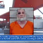 A man with a'swollen and bleeding' eye contacted 911 after leaving long black hairs on the knife used to kill a woman, according to authorities.