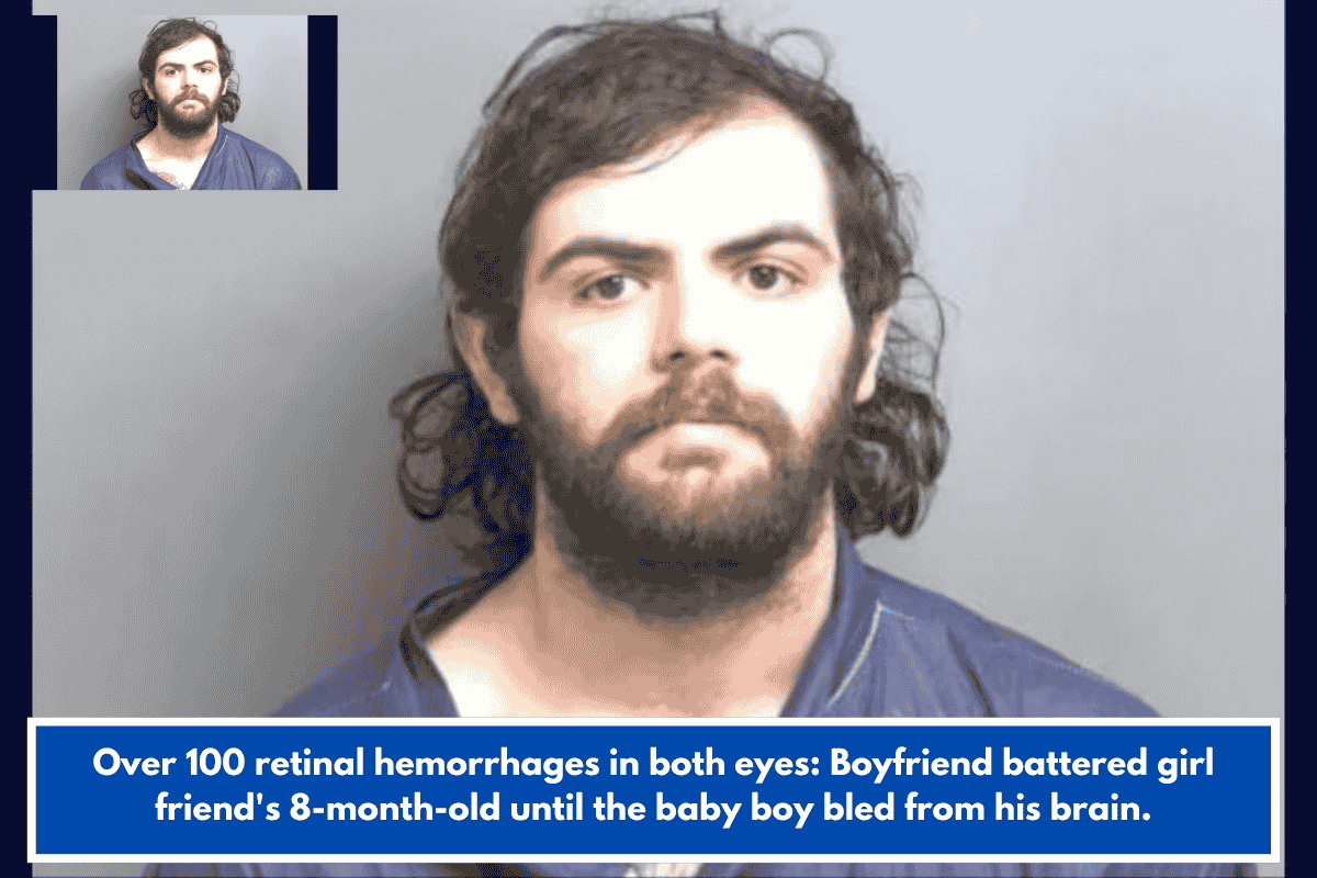 Over 100 retinal hemorrhages in both eyes: Boyfriend battered girlfriend's 8-month-old until the baby boy bled from his brain.