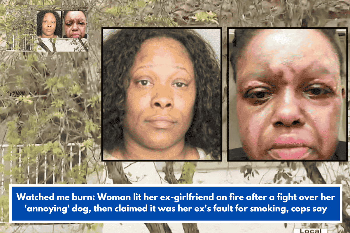 Watched me burn: Woman lit her ex-girlfriend on fire after a fight over her 'annoying' dog, then claimed it was her ex's fault for smoking, cops say