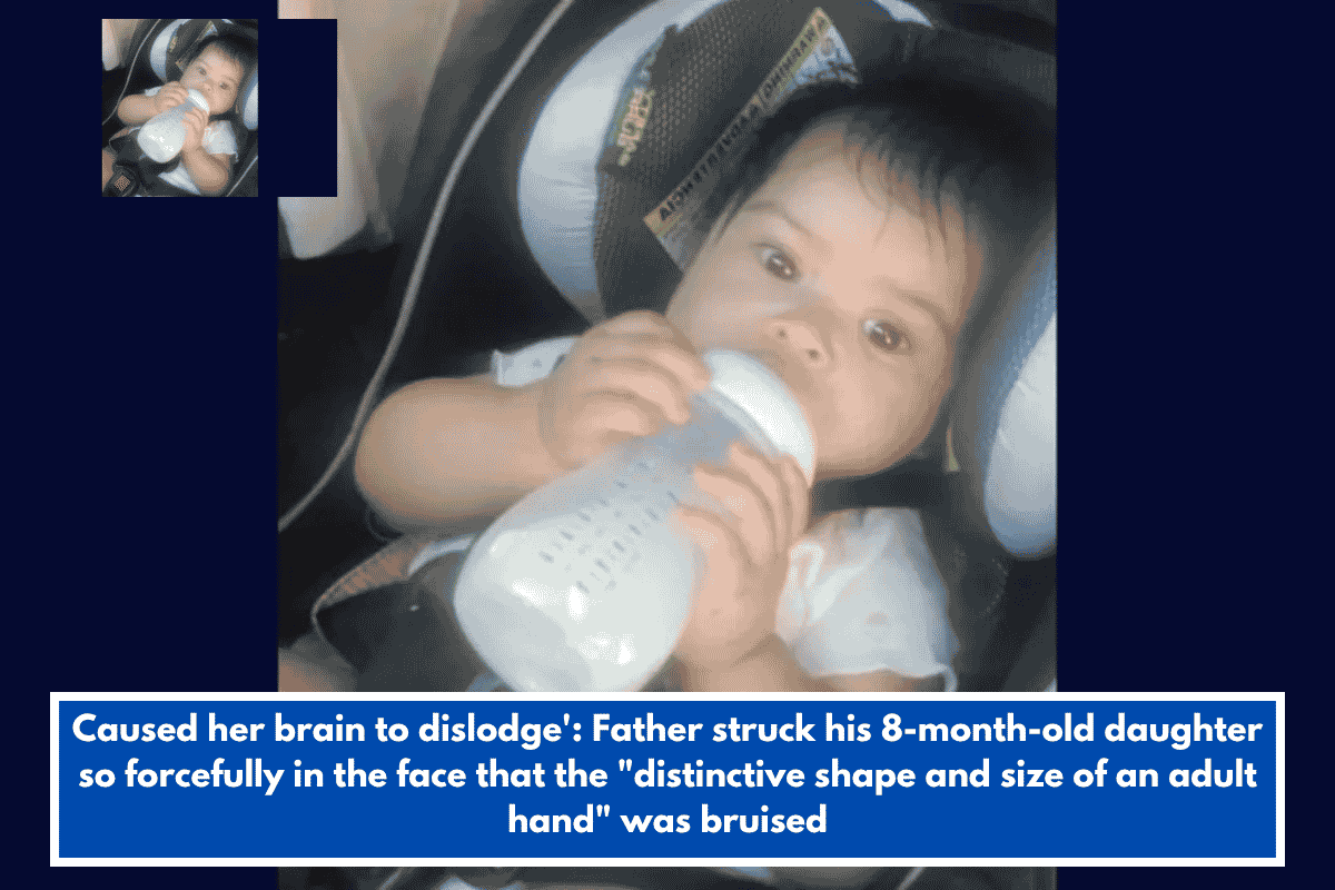 Caused her brain to dislodge': Father struck his 8-month-old daughter so forcefully in the face that the "distinctive shape and size of an adult hand" was bruised